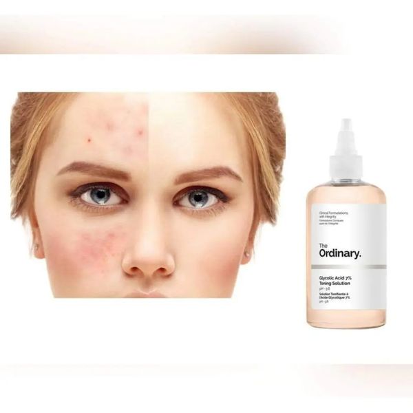 The Ordinary - Glycolic Acid 7% Exfoliating Toner - Tonik złuszczający z 7% kwasem glikolowym ordi_774 zdjęcie