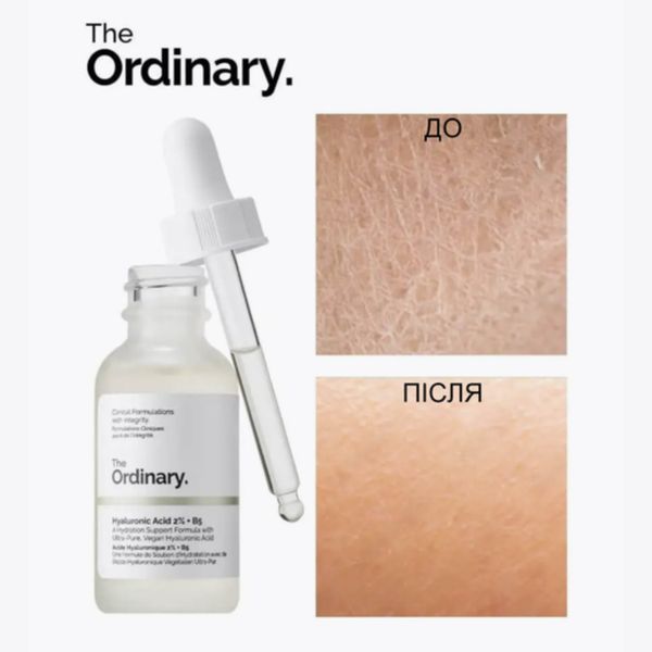 The Ordinary - Hyaluronic Acid 2% + B5 - Moisturising Serum with Hyaluronic Acid 2% and Vitamin B5 - 30ml ordi_20050 photo